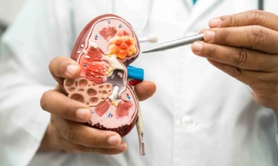 acute-kidney-injury