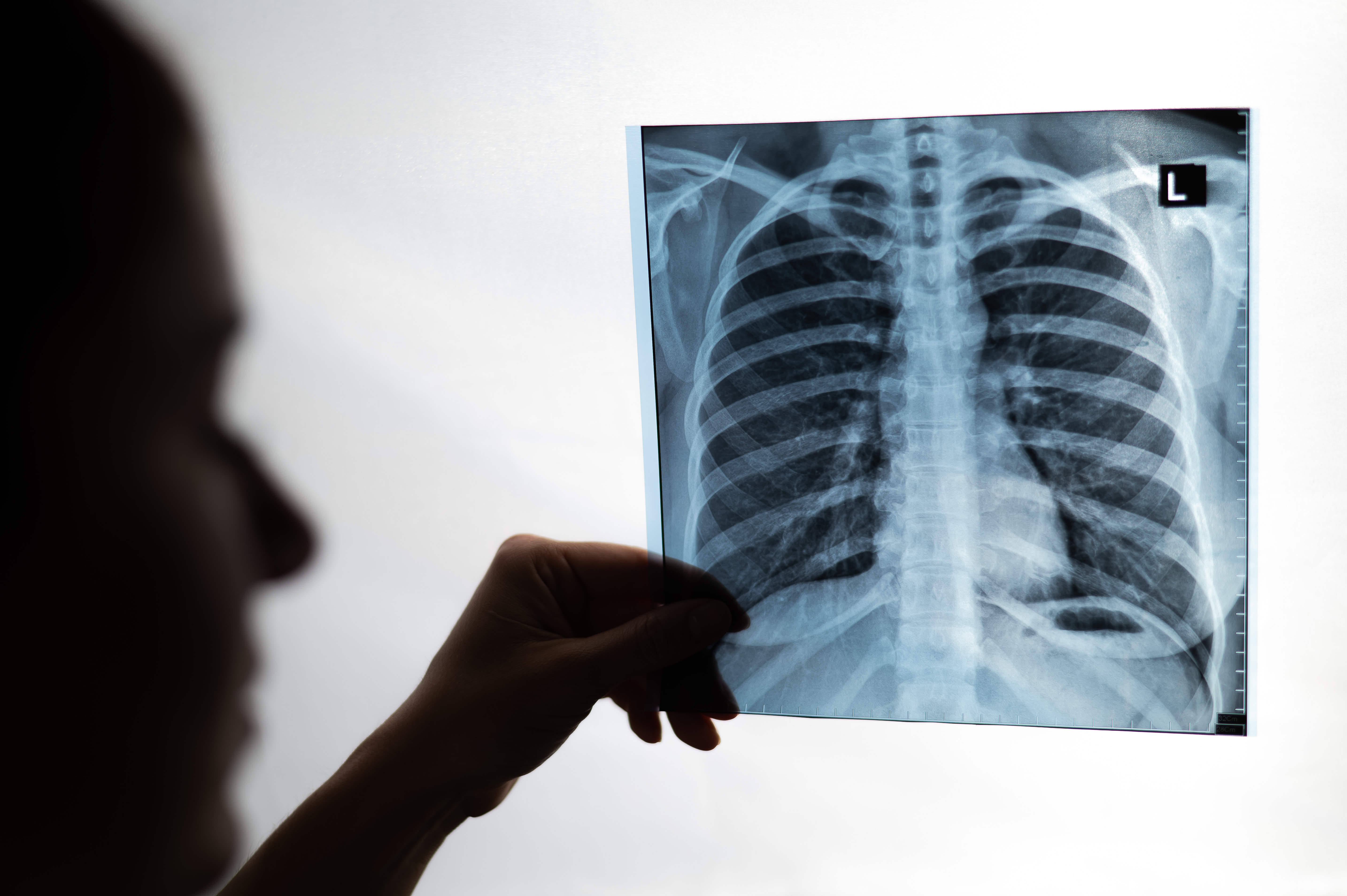 lung-center